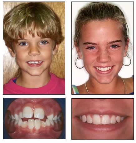 Before & After FJO Smiles Click here to see more FJO Smiles